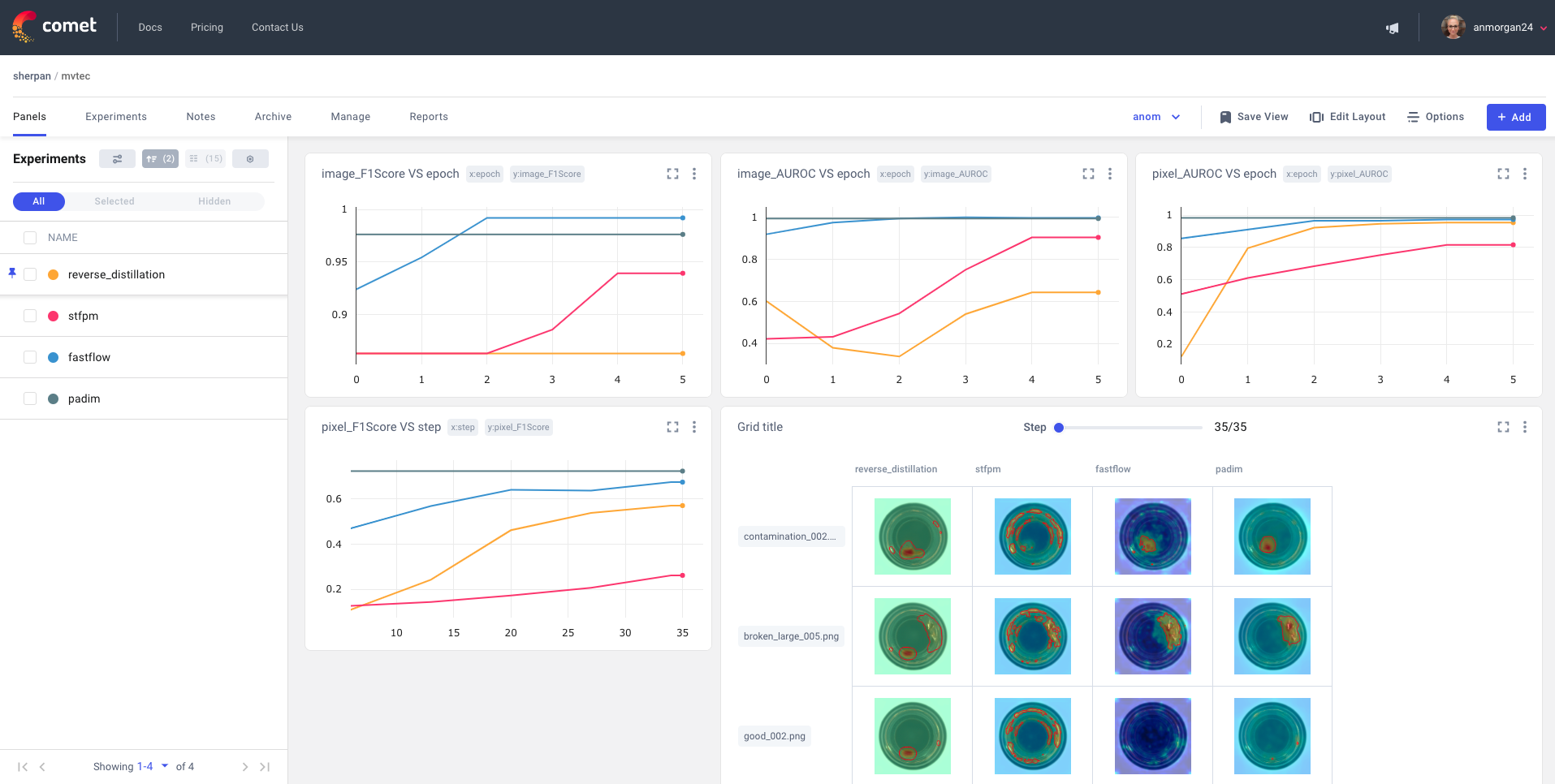 Project-level line charts of an anomaly detection experiment with Comet + Anomalib for Industry 4.0